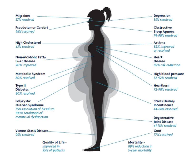 Weight management and bariatric surgery